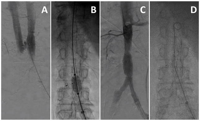 Fig. 15