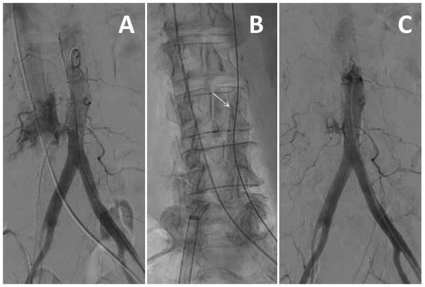 Fig. 14