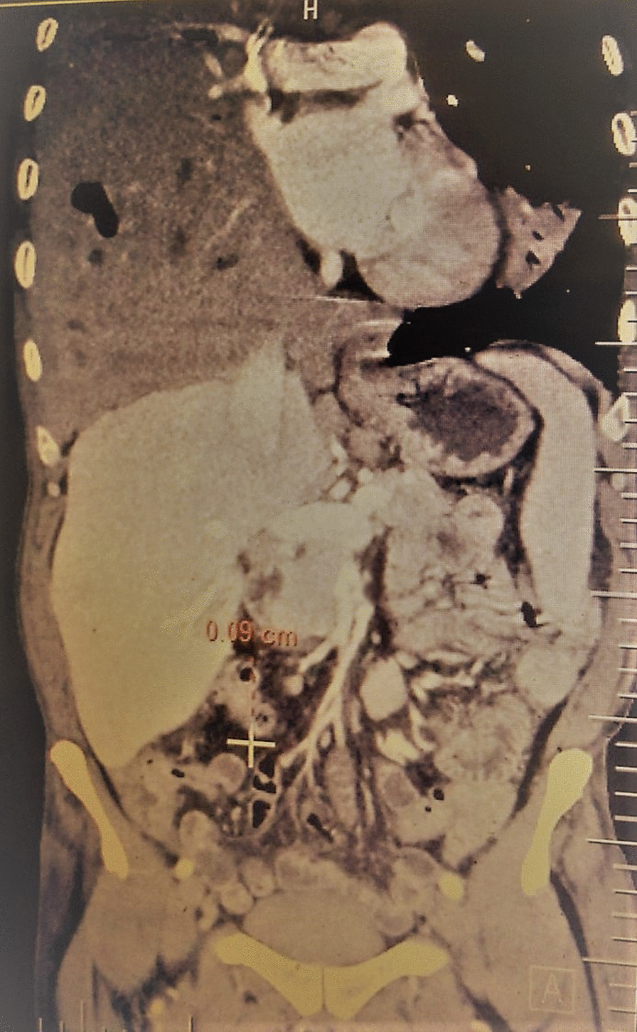 Fig. 3