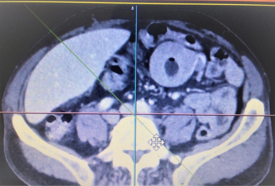 Fig. 6