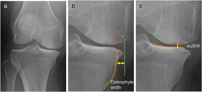 FIGURE 1