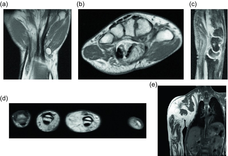 Figure 17.