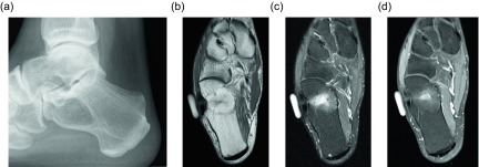 Figure 14.