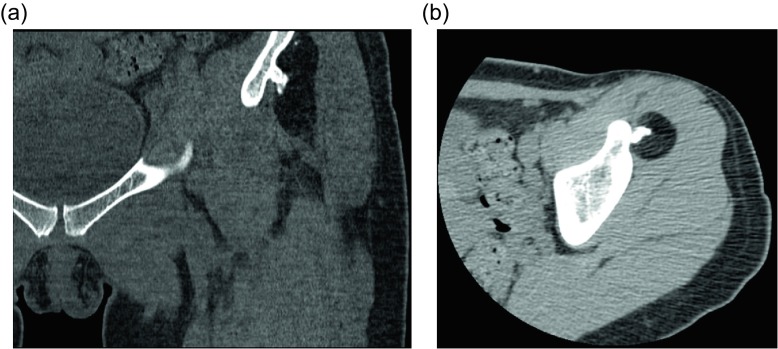 Figure 11.