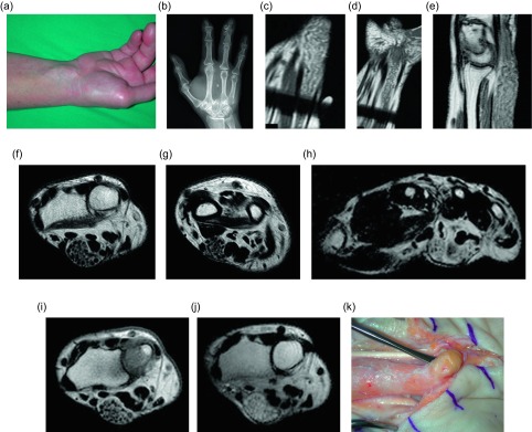 Figure 16.