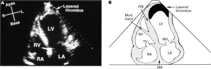 Figure 2  