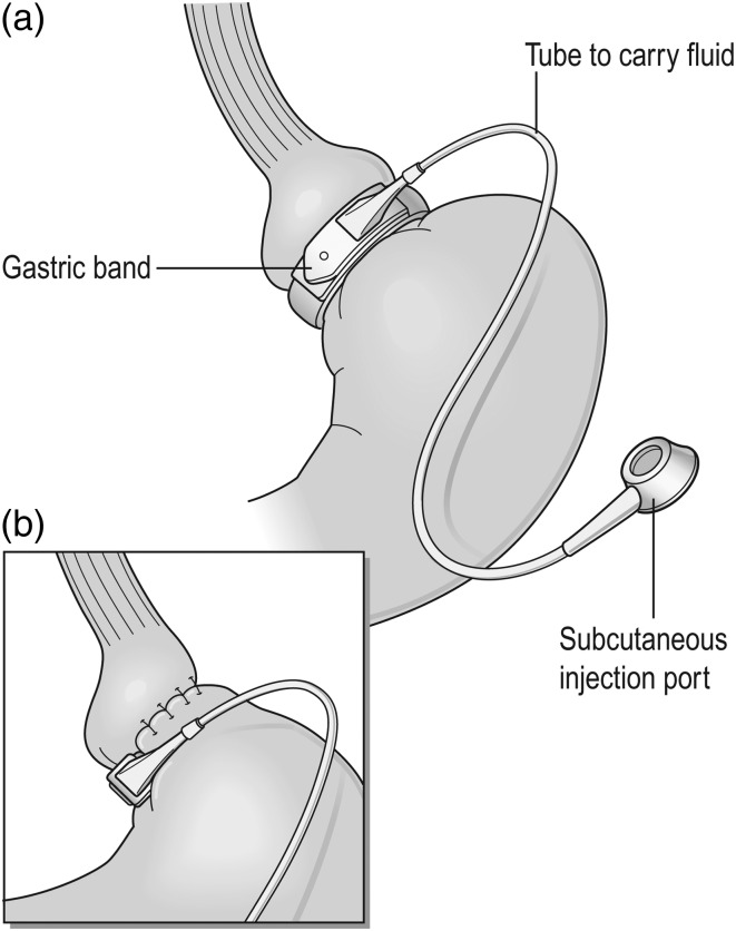 Fig. 1