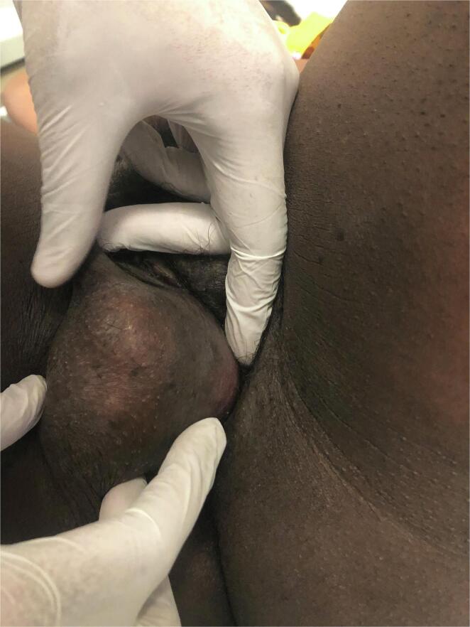 Fig. 1B