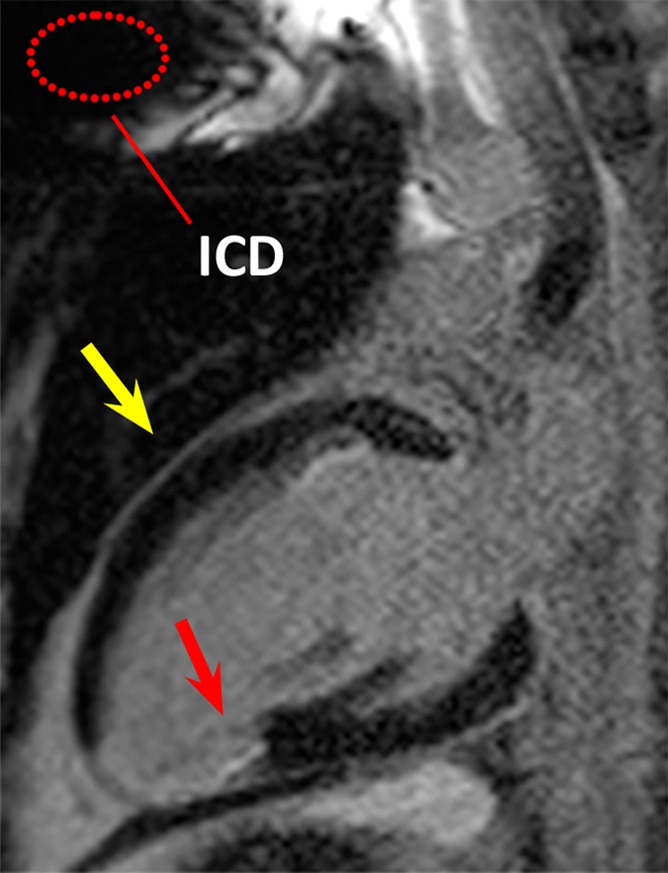 Figure 2b: