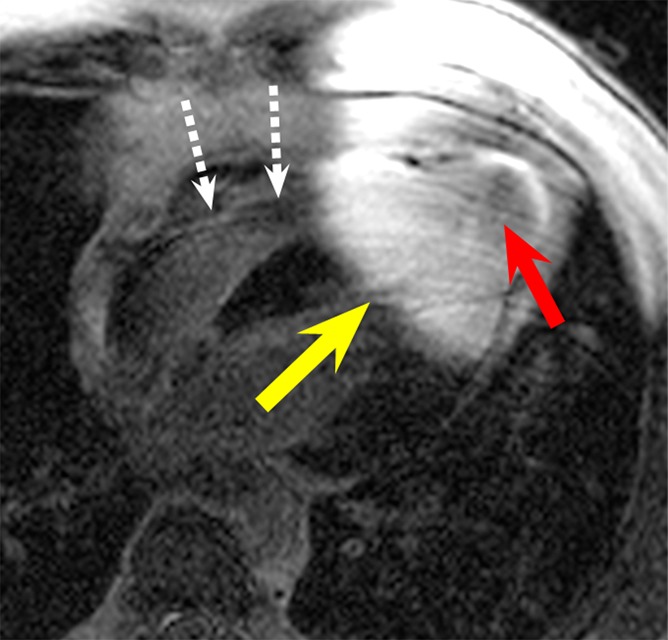 Figure 5a: