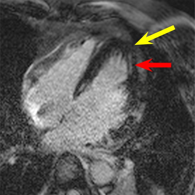 Figure 3b: