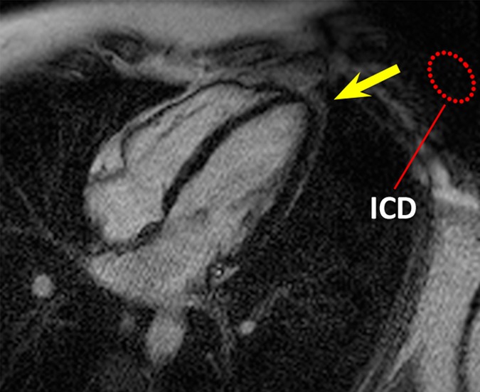 Figure 1c: