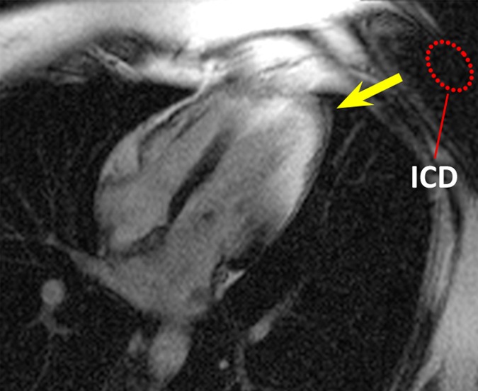 Figure 1b: