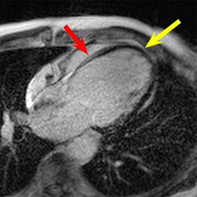 Figure 4b: