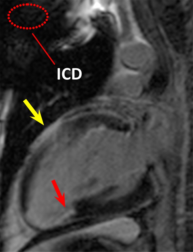 Figure 2a: