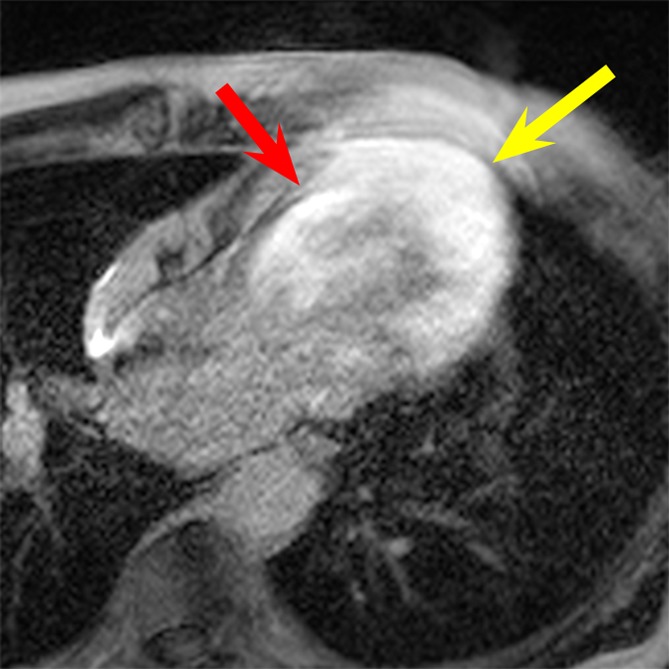 Figure 4a: