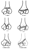 Fig. (2)