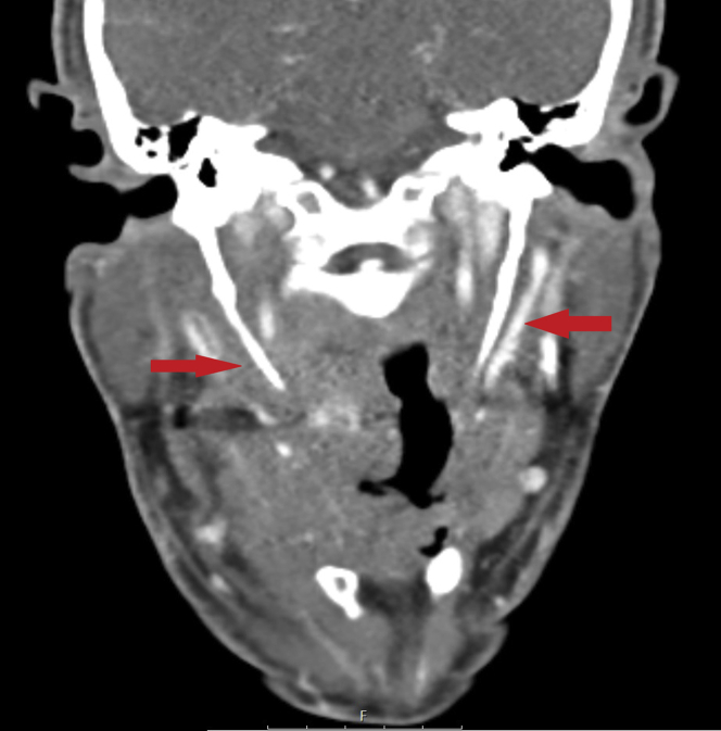 Figure 2