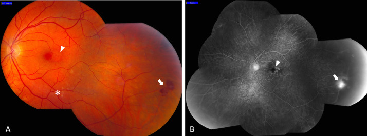 Fig 1