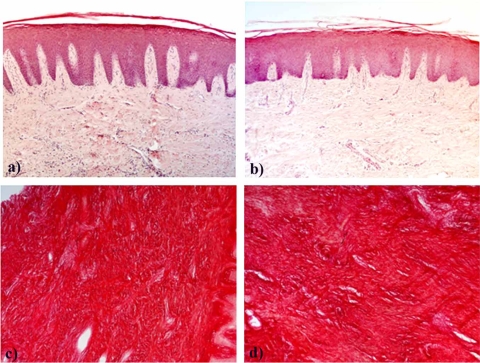 Fig. (1)