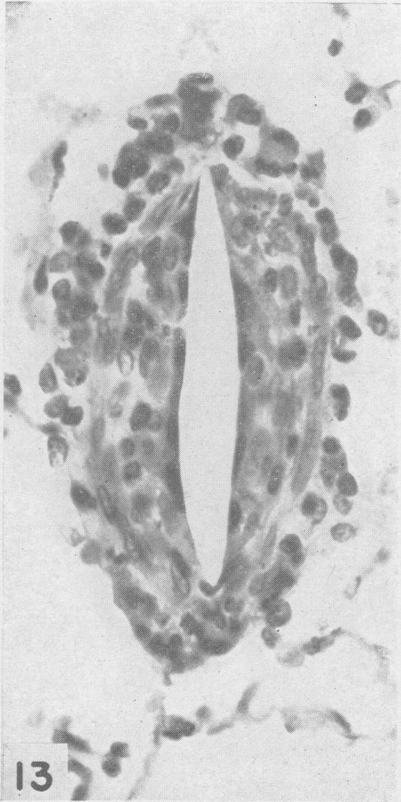 Fig. 13