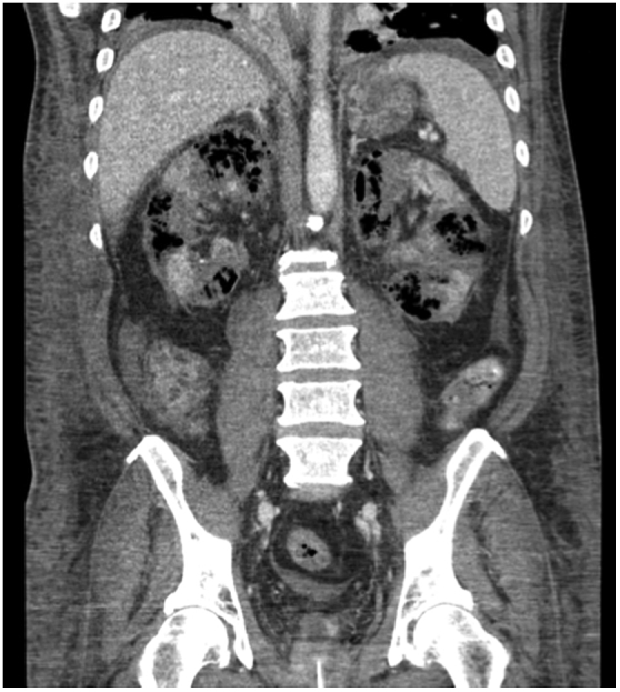 Fig. 2