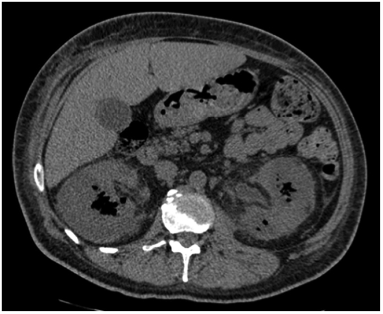 Fig. 3