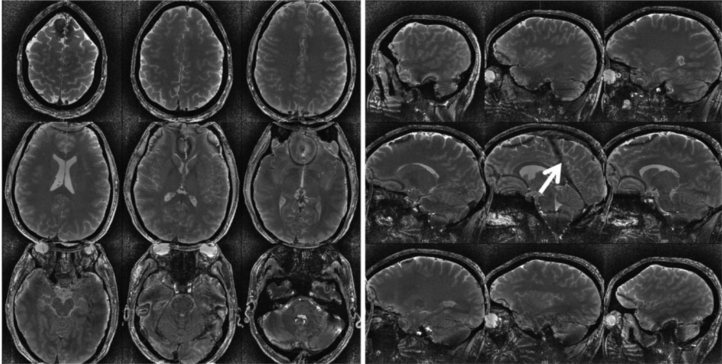 FIG. 7