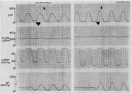 Fig. 3B