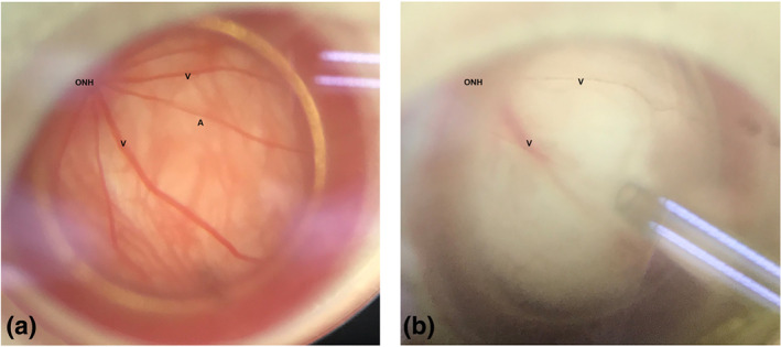 FIGURE 4