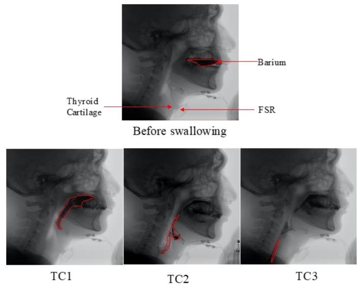 Figure 6