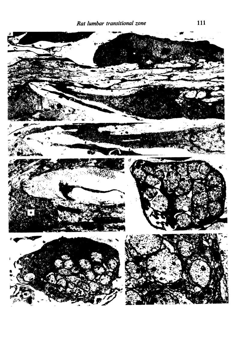 The Lumbar Ventral Root-spinal Cord Transitional Zone In The Rat. A 