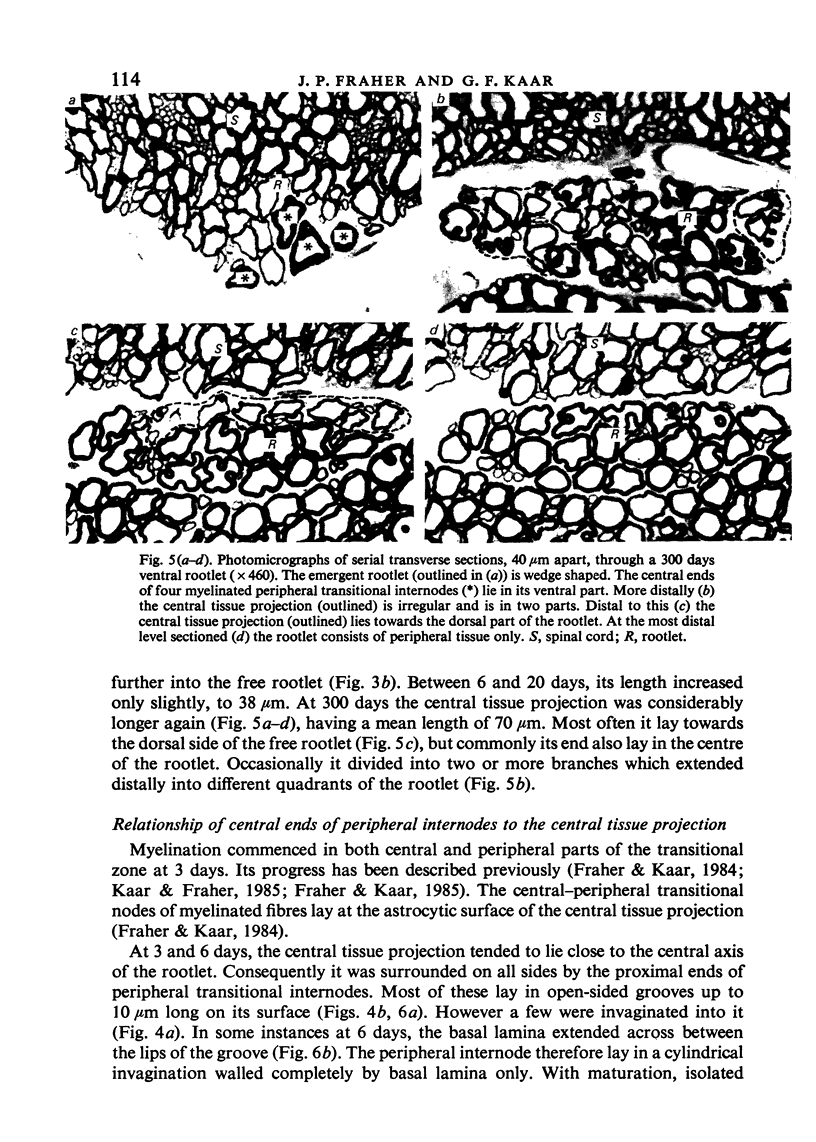 The Lumbar Ventral Root-spinal Cord Transitional Zone In The Rat. A 