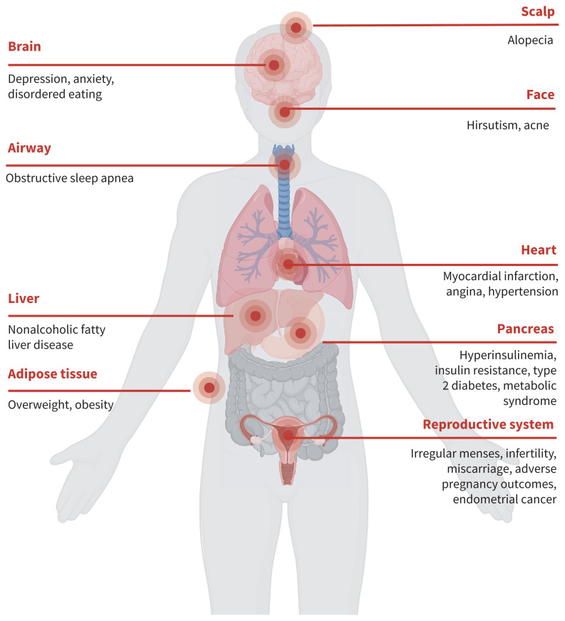Figure 1: