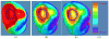 Fig. 11