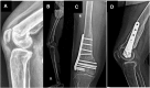 Fig 14