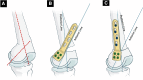 Fig 15