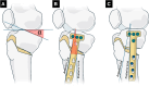 Fig 12