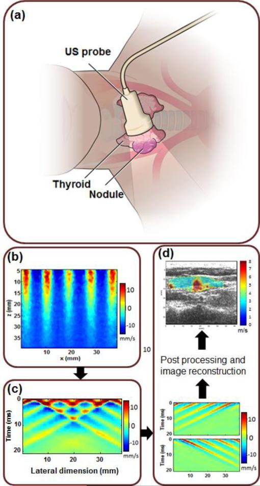 Fig. 1