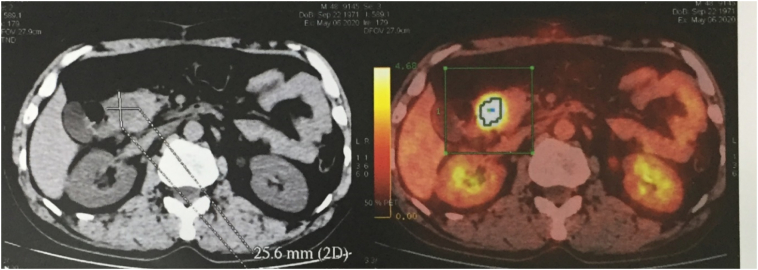 Fig. 5