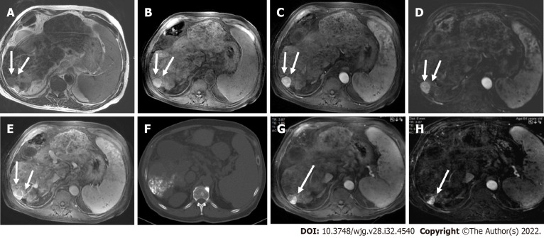 Figure 18