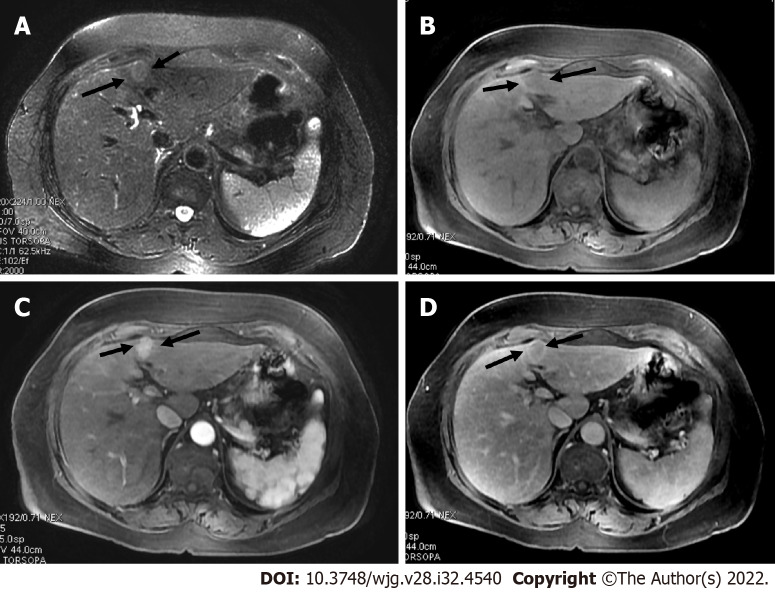 Figure 14