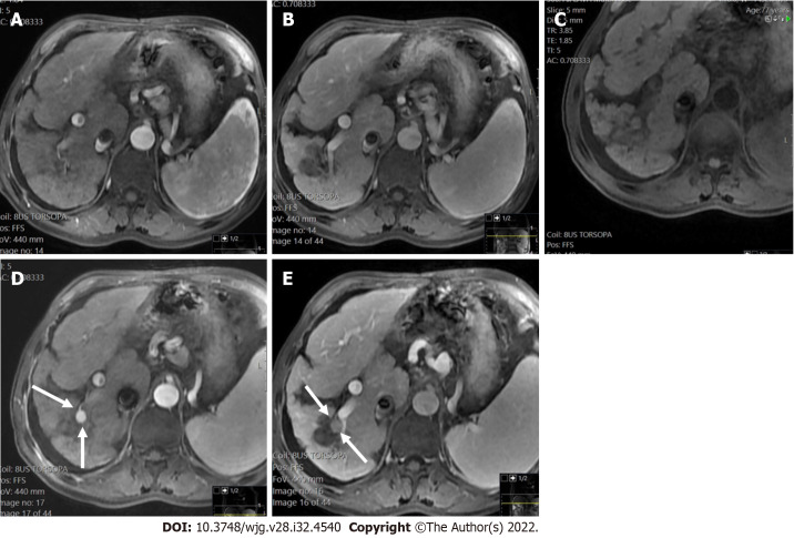 Figure 17