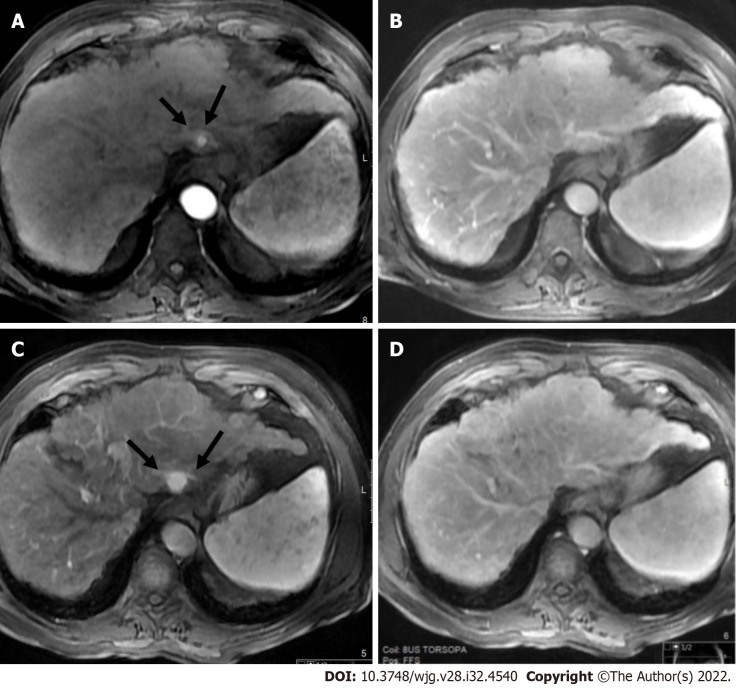 Figure 15