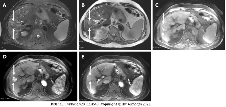 Figure 16