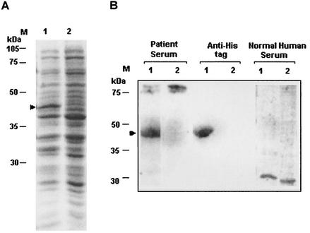 FIG. 12.