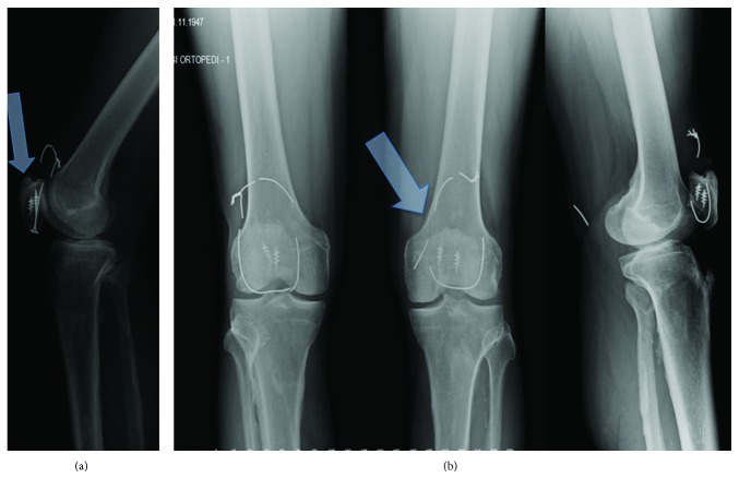 Figure 4