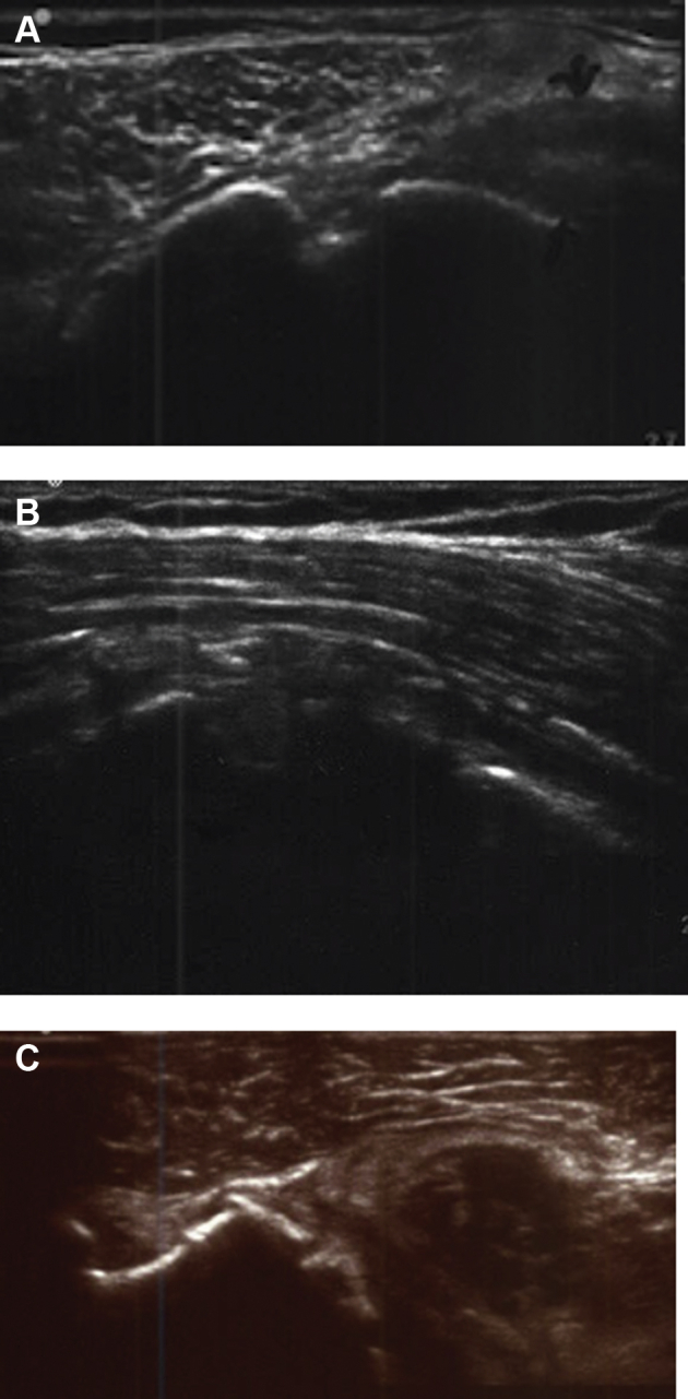 Figure 2