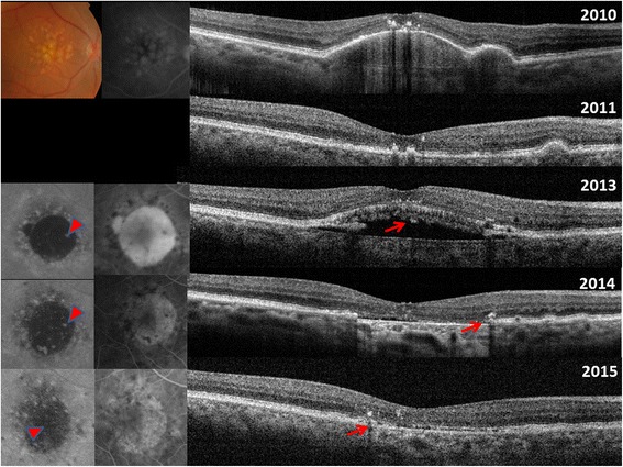 Fig. 1