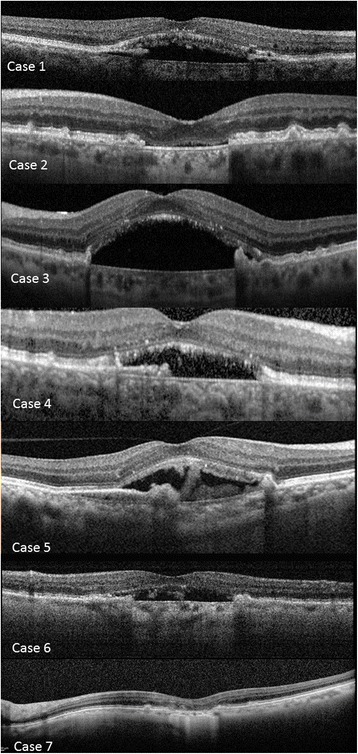 Fig. 4